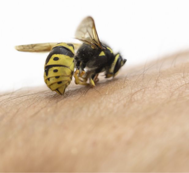 Bee Stinging Human Hand